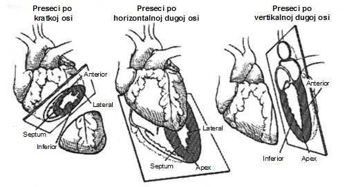 Sto je scintigrafija srca